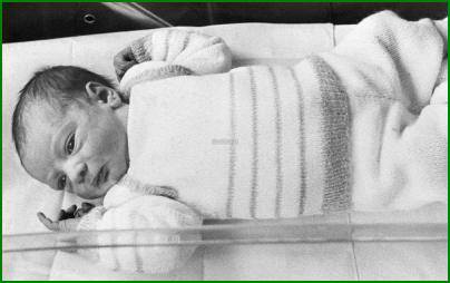 Amandine, premier bébé éprouvette